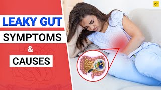 What is Leaky Gut Symptoms and Causes guthealth  Credihealth [upl. by Tessa]