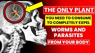 KILLS Parasites and Worms with ONLY 2 Spoons [upl. by Siusan302]