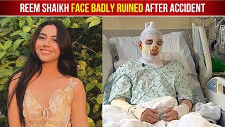 Reem Shaikh Badly Injured And Admitted To Hospital After Hot Oil Splash All Over Her Face [upl. by Yahsal]