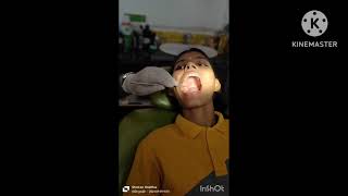 Tooth restorationfunnyDental filling dentist oralhealth funny [upl. by Roley122]