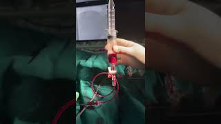 How Manual Thrombus Aspiration Catheter Works [upl. by Brass]