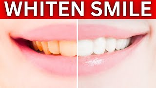 How To Whiten Your Teeth Naturally  Natural Remedies For Teeth Whitening [upl. by Wattenberg366]