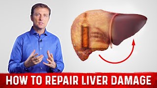 Fix Liver to Fix Hormones  Hormone  Liver Connection [upl. by Tsenrae]