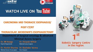 THORACOLAP MCKEOWN’S ESOPHAGECTOMY FOR CARCINOMA MID THORACIC ESOPHAGUS POST CTRT [upl. by Obe]