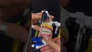 Denture fabrication in prosthodontics shorts viral trending bds satisfying prosthodontics [upl. by Nosrac416]