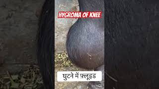 Hygroma of knee l Dr Umar Khan [upl. by Anieral147]