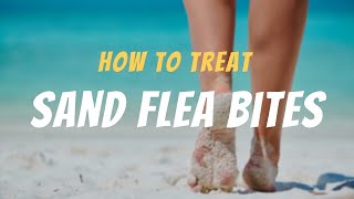 Immediate Action How to Treat Sand Flea Bites Like a Pro [upl. by Ariak]