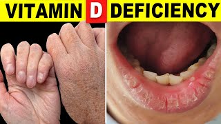 10 Signs Your Body Is Begging for Vitamin D [upl. by Misty917]