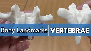 Bony Landmarks of the Vertebrae [upl. by Abert]