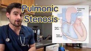 Pulmonic Stenosis in Pets [upl. by Anegroeg138]