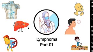 Lymphoma  Hodgkins lymphoma  Sign and symptoms  Diagnosis  Treatment [upl. by Anthony]