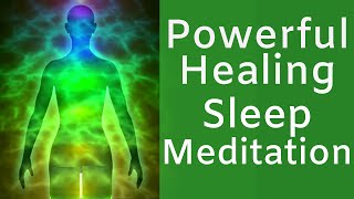 HEAL while you SLEEP  Powerful Sleep Meditation for Rapid Healing [upl. by Murtha]