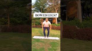 BOWED LEGS CORRECTION Exercise bow alignment correction selfcare healthtips physiotherapy [upl. by Phineas]