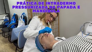 PRÁTICA DE INTRADERMO PRESSURIZADA NA PAPADA E MANDÍBULA [upl. by Akineg]