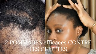 2 pommades miracle contre les chutes de cheveux  comment faire pousser ses cheveux rapidement [upl. by Larine383]