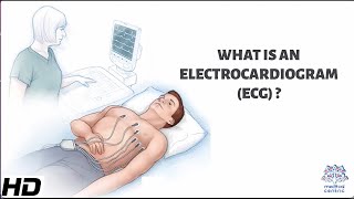 What Is An Electrocardiogram [upl. by Nallij]