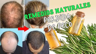 Remedios naturales y caseros para la perdida de pelo🌿 [upl. by Eetnwahs175]