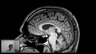 Cingulate gyrus [upl. by Thibaud]