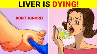 16 Warning Signs Your Liver Is Failing  When to Seek Help Immediately [upl. by Theressa]