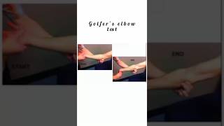 Golfers Elbow Test kattrucate medicalreels golfers elbow sign supination examiner shorts [upl. by Hashum]