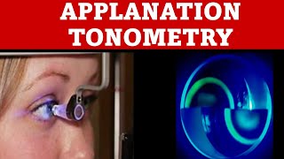 Applanation Tonometry  how to do goldmann applanation tonometry [upl. by Auliffe165]