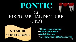 PONTIC IN FIXED PARTIAL DENTURE FPD [upl. by Arratahs]