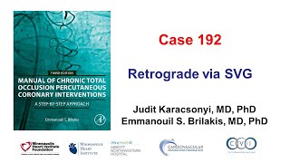 Case 192 Manual of CTO PCI  Retrograde via SVG [upl. by Eciralc448]