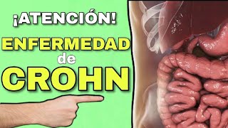 ENFERMEDAD de CROHN🤯 ¿QUÉ ES ¿CAUSAS ¿FISIOPATOLOGÍA 📌 [upl. by Annaet]