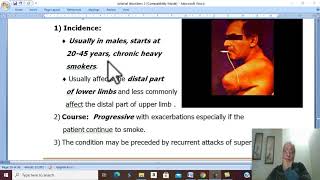 Arterial Disorders in Arabic 27  Buergers Disease  part 1   by Dr Wahdan [upl. by Enened]