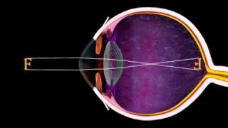 The Eye and Focus  3D Medical Animation  ABP © [upl. by Eleen148]