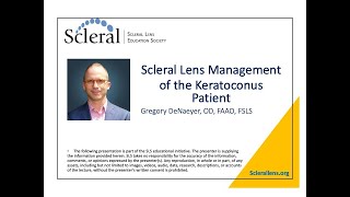 Scleral Lens Management of the Keratoconus Patient [upl. by Ellennad]