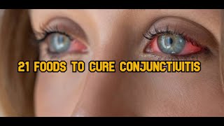 21 Foods to cure conjunctivitis [upl. by Schwing]