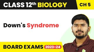 Downs Syndrome  Principles of Inheritance and Variation  Class 12 Biology 202223 [upl. by Celine]