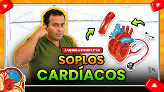 SOPLOS CARDIACOS APRENDE A INTERPRETARLOS ✍🩺 🔊  Semiología Cardiaca [upl. by Yecniuq]