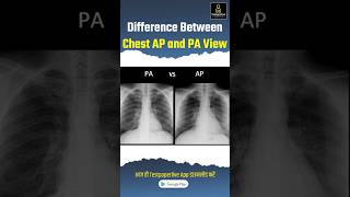 Difference between Chest AP amp PA view apview paview ChestAP Chestpa testpaperlive xray [upl. by Anitnahs]