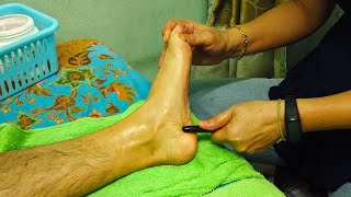 I got Healthy THAI FOOT MASSAGE Reflexology with Acupressure Stick [upl. by Sabella814]