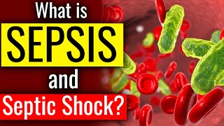 What is SEPSIS and SEPTIC SHOCK  The Bodys Deadly response to Infection Sepsis  Cause Symptom [upl. by Zandt]