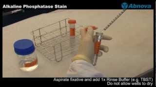 Alkaline Phosphatase Stain [upl. by Kattie]