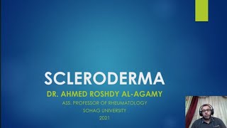 4 Systemic Sclerosis Scleroderma [upl. by Cuyler609]