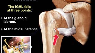 Lesions Of The Shoulder HAGL Lesion  Everything You Need To Know  Dr Nabil Ebraheim [upl. by Merissa461]