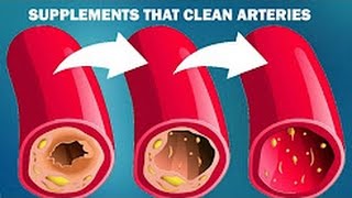 7 Best supplements that will clean your arteries naturally at home [upl. by Gleeson]