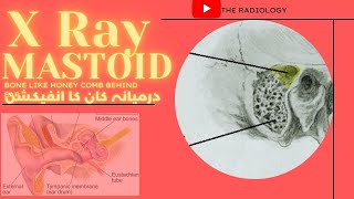 X Ray Mastoid Bone behind the ear in urduhindi कर्णमूल [upl. by Sera]