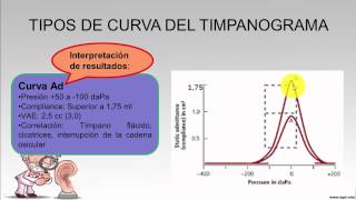 Audiología Cómo se realiza la impedanciometría [upl. by Thalia]