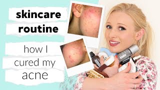 My full skin care routine amp how I CURED my acne [upl. by Reider]