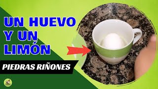 Eliminar piedras en los riñones solo necesitas un huevo y un limón [upl. by Valma]