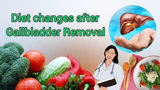 Diet changes after Gallbladder Removal [upl. by Nehcterg]