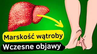 12 Pierwszych Objawów Uszkodzenia Wątroby  Przewodnik po Zdrowiu Wątroby [upl. by Stewardson]