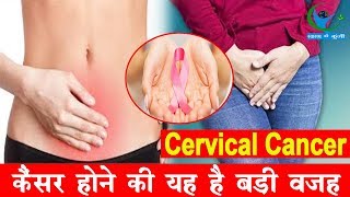 इतना खतरनाक होता है Cervical Cancerजानें इसके लक्षण और कारणSymptoms Of Cervical Cancer [upl. by Derward]