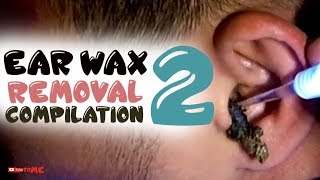 EAR WAX REMOVAL COMPILATION 2 [upl. by Yllod]