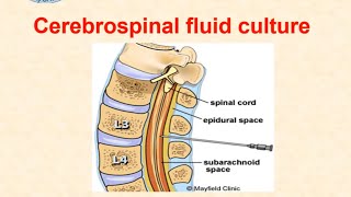 Cerebrospinal fluid culture  dr Ismail [upl. by Akeylah]